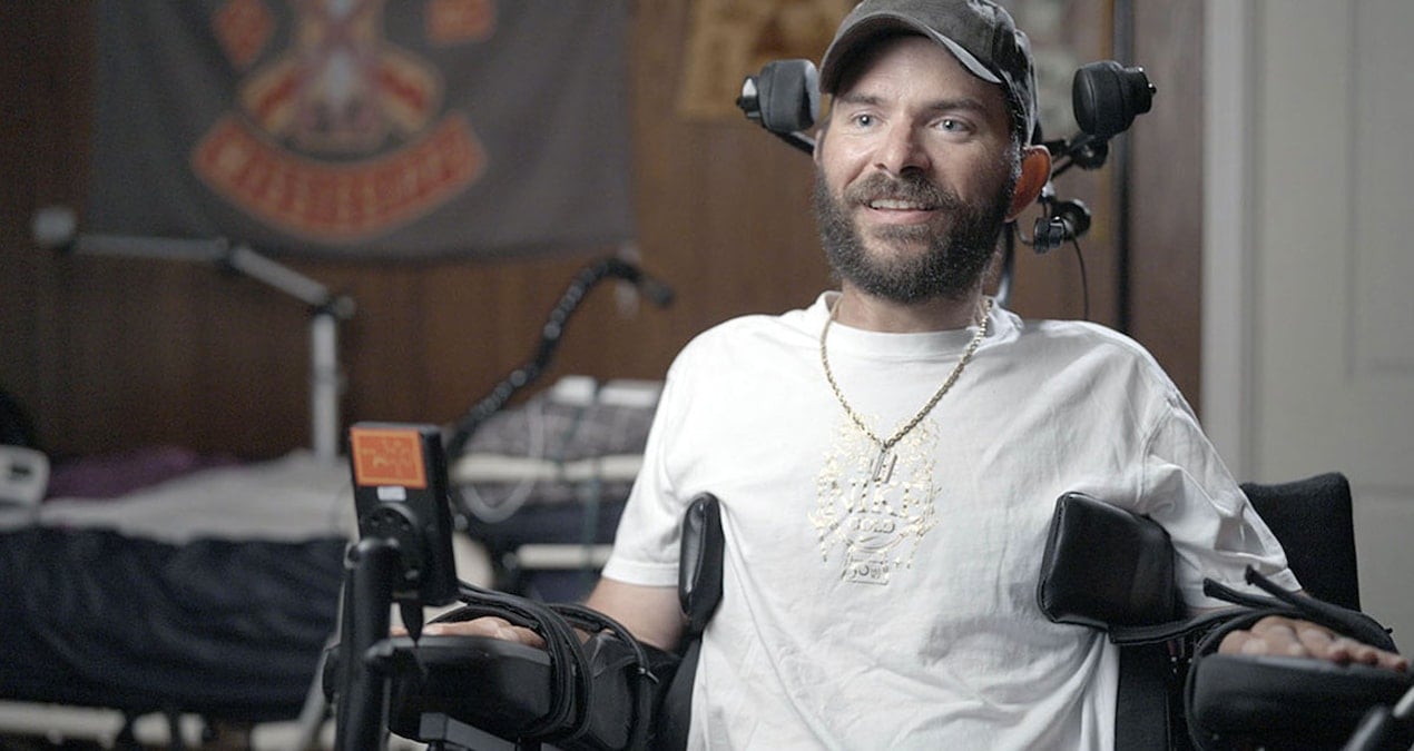 felcli hastalarin umudu mucize cip 12 kisiye yerlestirildi Y88OjPUM